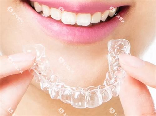 隐形矫正器图示