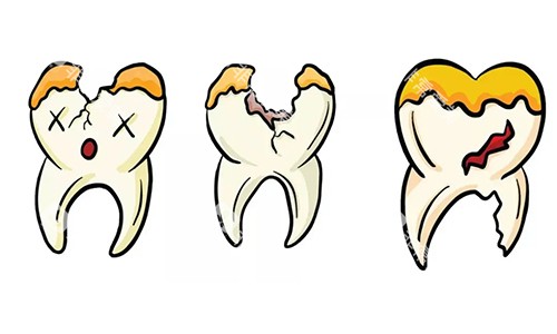 牙齿坏了一半动画图 牙齿坏了一半动画图