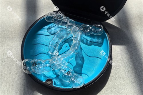 隐适美牙齿矫正 隐适美牙齿矫正