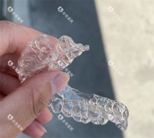国产隐形牙套照片