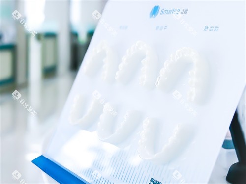 牡丹江立康口腔隐形矫正牙套模型