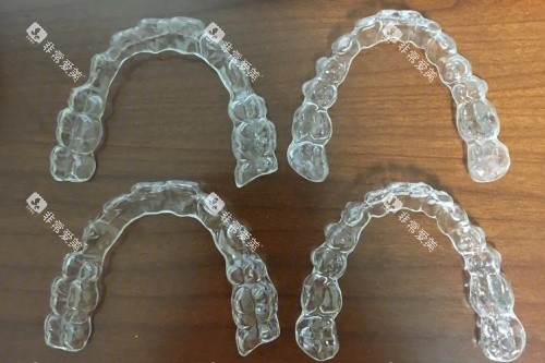 隐形牙套示意图