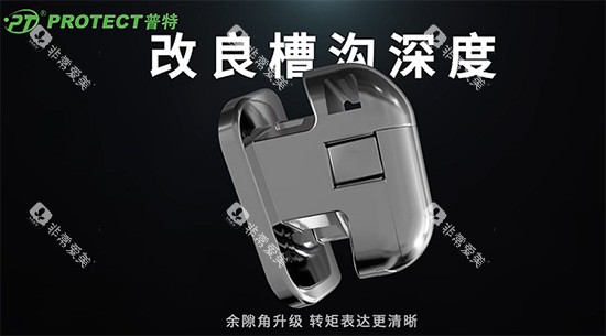 普特牙套技术特色