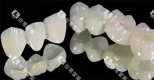 二氧化锆全瓷牙