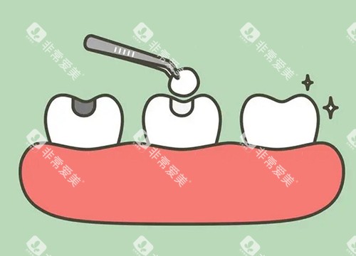 补牙改善照片示意