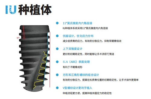 韩国沃兰种植牙怎么样 韩国沃兰种植牙怎么样