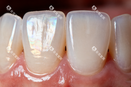 健康正常牙齿卡通图 健康正常牙齿卡通图