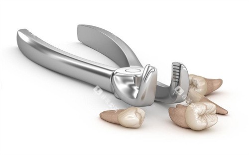 拔牙展示图卡通 拔牙展示图卡通