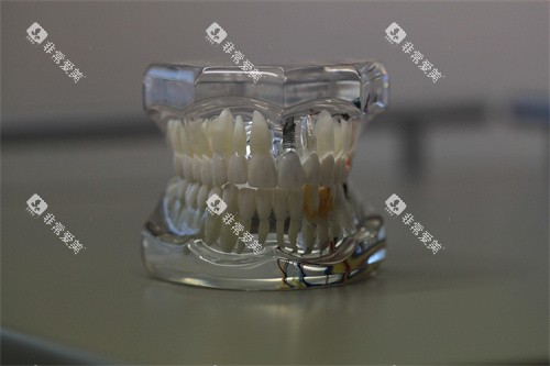 牙齿模型示意图宣传