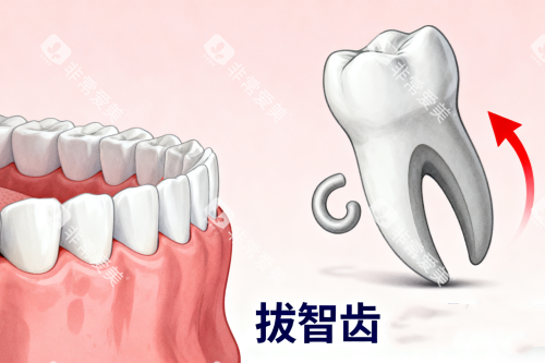 拔智齿卡通一览图 拔智齿卡通一览图