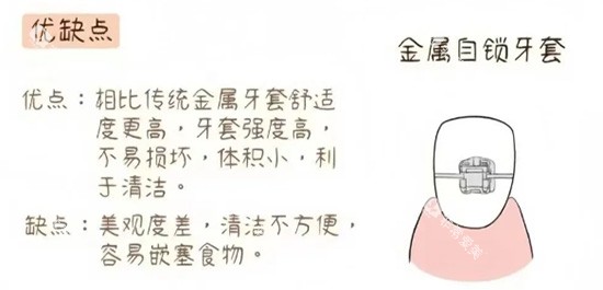 金属自锁牙套照片示意图 金属自锁牙套照片示意图