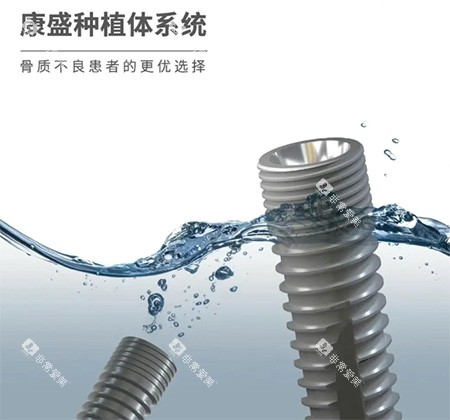 康盛种植牙怎么样