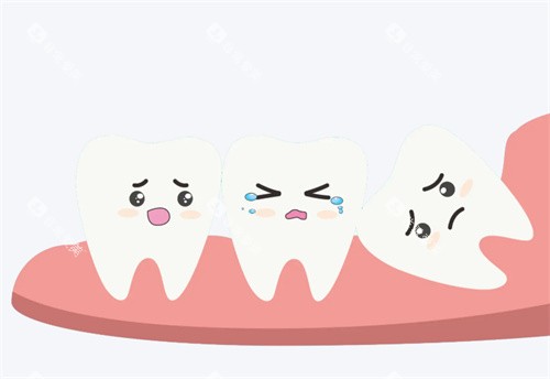 智齿动画图片 智齿动画图片