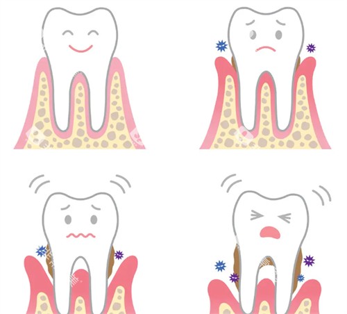牙齿松动解决办法 牙齿松动解决办法