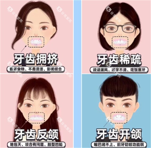 牙齿矫正自查表 牙齿矫正自查表