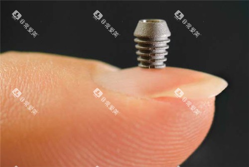 美国百康种植牙展示