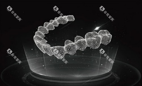 隐形牙套图示 (2)