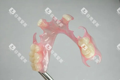 活动义齿实拍示意图