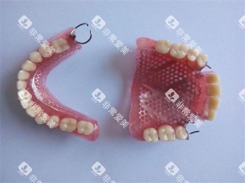 普通全口义齿假牙实物图