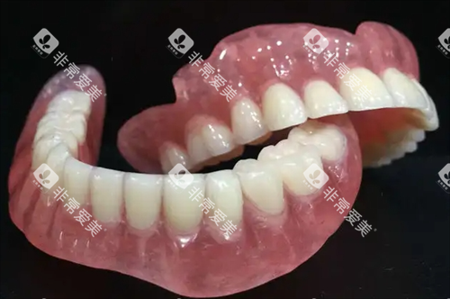 吸附式假牙半口模型展示