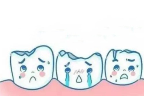 牙齿缺损卡通展示图