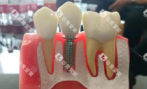 黄冈新起点口腔牙齿模型实拍图