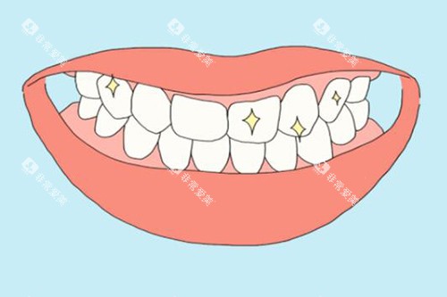 牙齿美白改善图展示