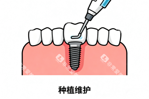 种植牙维护卡通图