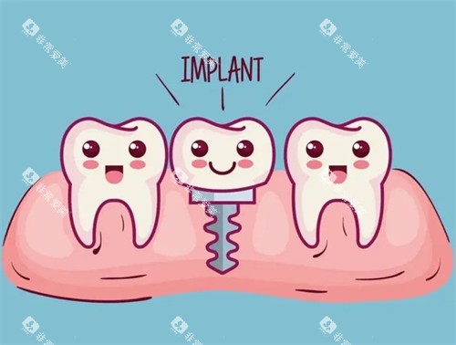 种植牙漫画示意图 种植牙漫画示意图