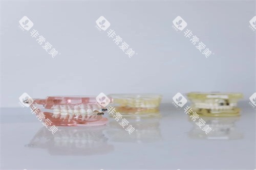 牙齿模型示意展示