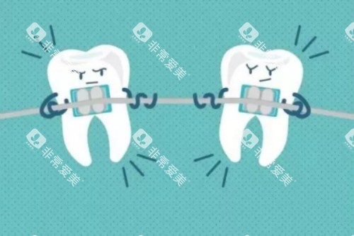 牙齿矫正卡通图