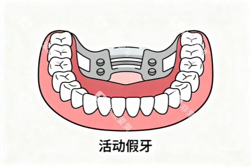 活动假牙卡通图 活动假牙卡通图