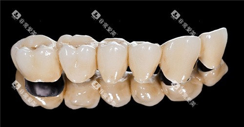一排烤瓷牙素材