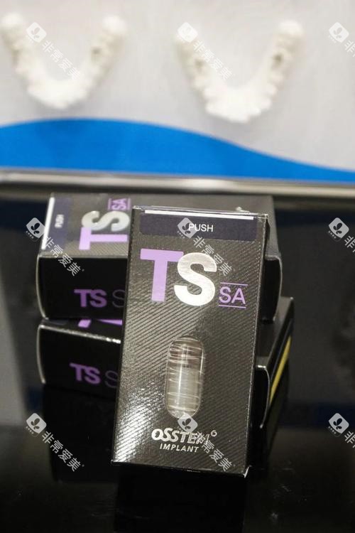 奥齿泰TS种植牙 奥齿泰TS种植牙