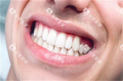 整齐的牙齿图片展示