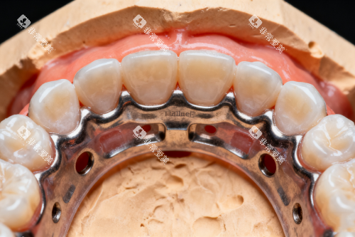 牙齿矫正之后的样子展示 牙齿矫正之后的样子展示
