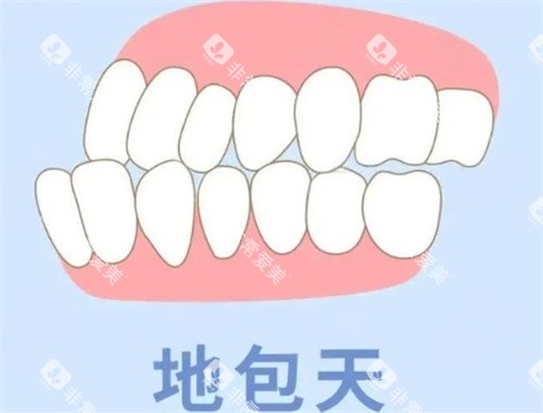 地包天动画展示图