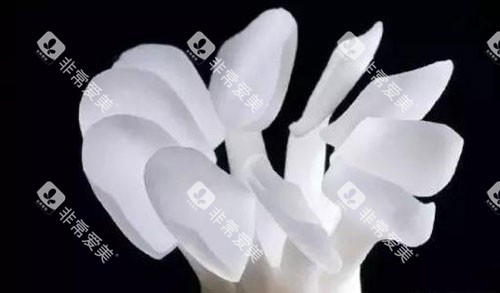 牙齿树脂贴面示意图