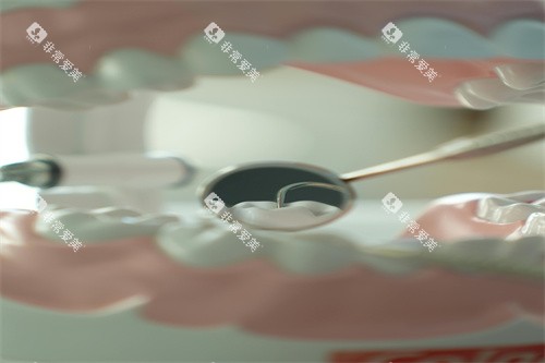 牙齿治疗细节展示