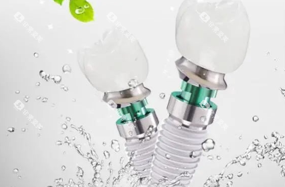 iti亲水种植体展示 iti亲水种植体展示