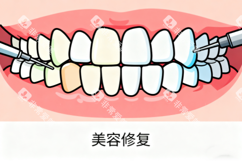 牙齿美容修复卡通图 牙齿美容修复卡通图