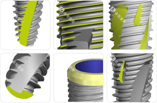 瑞士百丹特种植牙设计特写