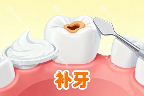 补牙卡通展示一览