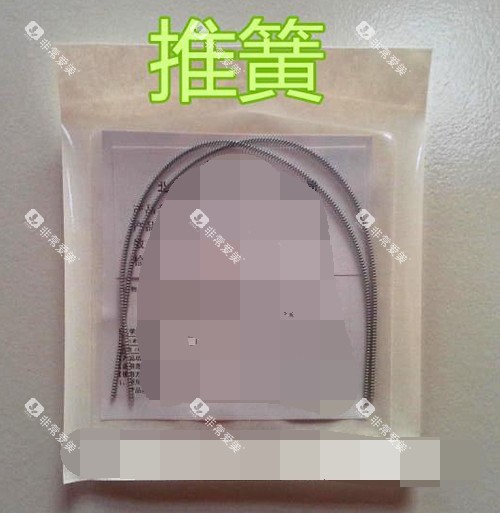 牙齿矫正正畸推簧材料