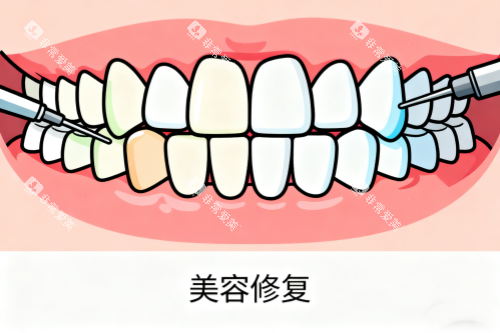 牙齿美容修复卡通图 牙齿美容修复卡通图