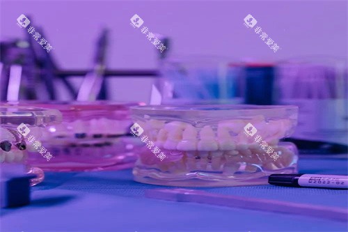 牙齿模型示意图展示 牙齿模型示意图展示