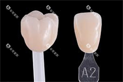 西诺德全瓷牙成品