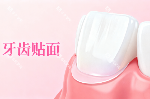 牙贴面卡通图片一览 牙贴面卡通图片一览