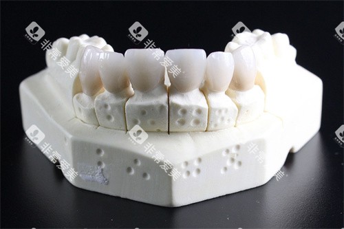 牙齿模型展示图 牙齿模型展示图
