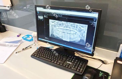 温州牙贝恩口腔牙齿治疗方案设计